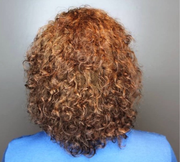 Nioxin Dermabrasion Treatment  Scalp Renew for You